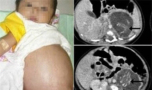 su that phia sau cau chuyen be gai vua sinh ra da tro thanh “me” - 1