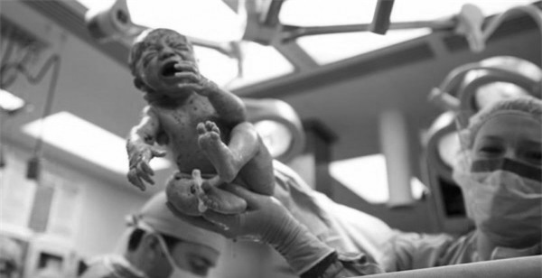 dang mo de, bac si bang hoang khi nhan thay dieu nay trong o bung san phu - 3