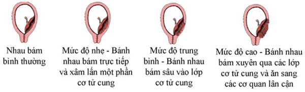 dang mo de, bac si bang hoang khi nhan thay dieu nay trong o bung san phu - 7