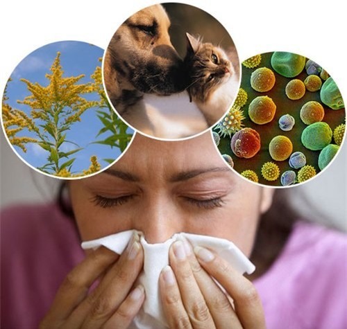 Nếu không muốn thức dậy với cổ họng khô rang thì làm ngay 4 điều để chấm dứt việc thở bằng miệng - Ảnh 2.