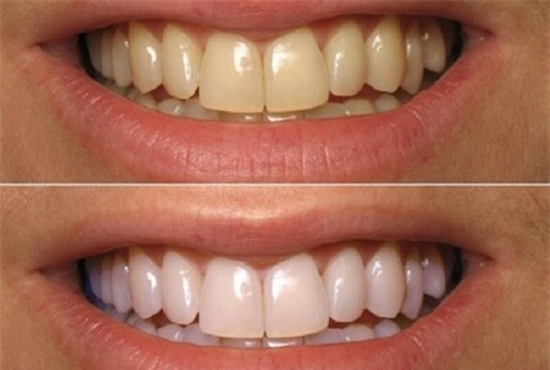 trang-rang-blogtamsuvn22