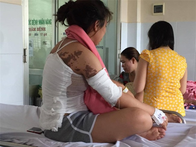 Co gai 23 tuoi bi hang xom tat axit co nguy co hong mat hinh anh 2