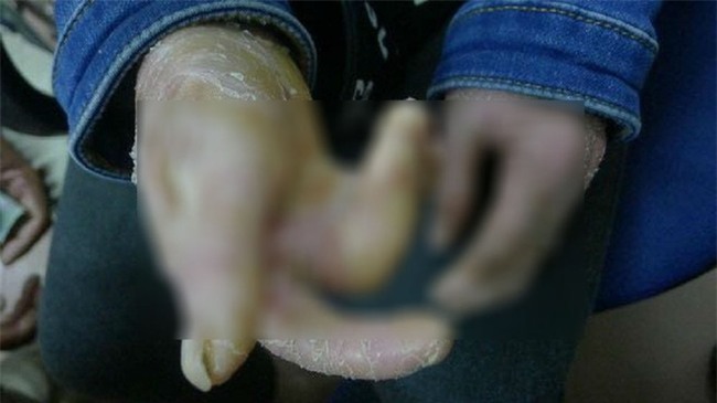 Đau xót cô gái 29 tuổi chơi piano rất hay nhưng mang hình hài quái nhân - Ảnh 2.