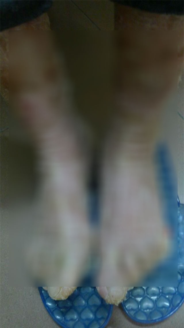 Đau xót cô gái 29 tuổi chơi piano rất hay nhưng mang hình hài quái nhân - Ảnh 3.