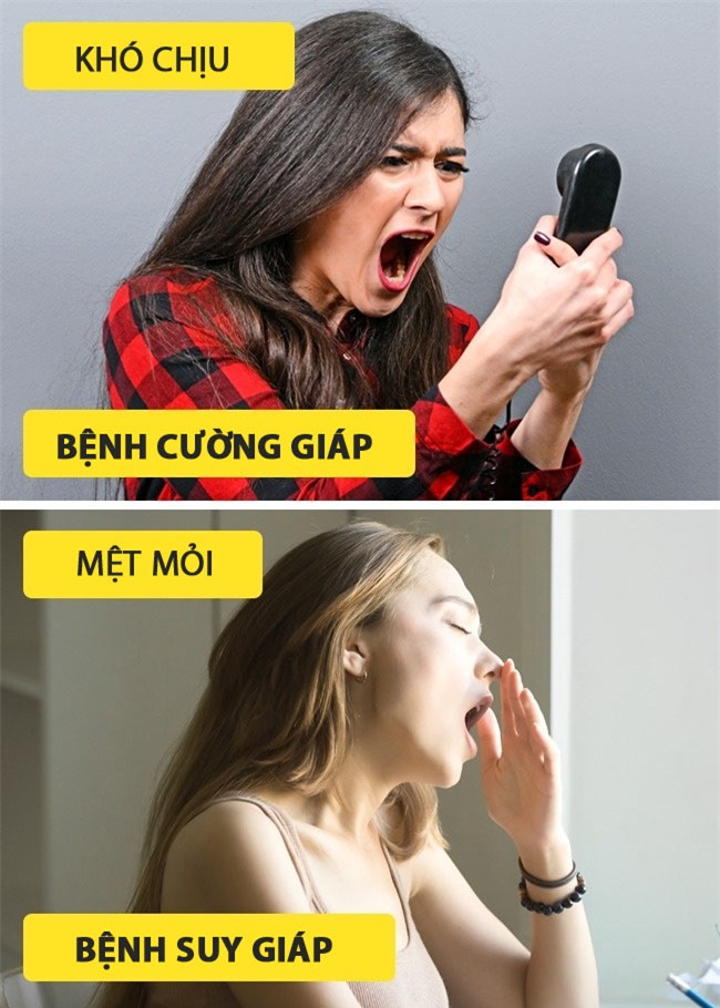 7 triệu chứng của bệnh tuyến giáp bạn không được bỏ qua - Ảnh 2.