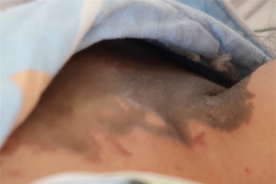 Lời kể kinh hoàng của 4 nạn nhân bị tạt a xít - Ảnh 1.