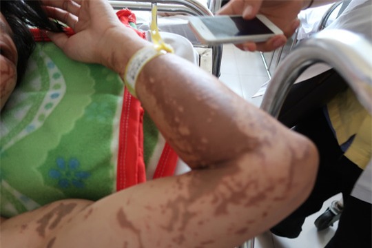 Lời kể kinh hoàng của 4 nạn nhân bị tạt a xít - Ảnh 4.