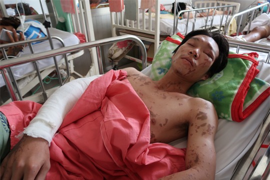 Lời kể kinh hoàng của 4 nạn nhân bị tạt a xít - Ảnh 5.