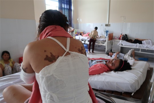 Lời kể kinh hoàng của 4 nạn nhân bị tạt a xít - Ảnh 8.