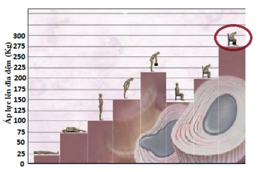 dân văn phòng, thoái hóa, thoái vị đĩa đệm