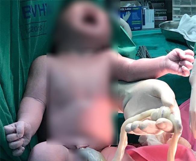 hi huu: be trai chao doi voi vong day ron that nut - 1