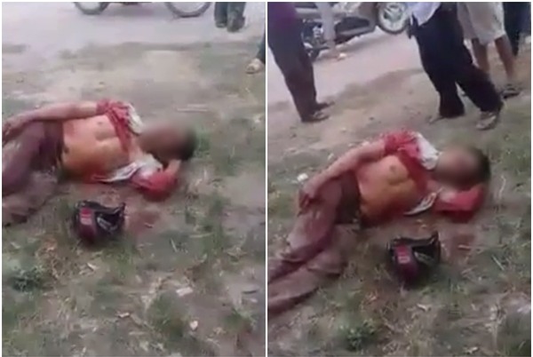 Tài xế xe ôm bị cướp đâm, bò ra đường quốc lộ kêu cứu - Ảnh 1.