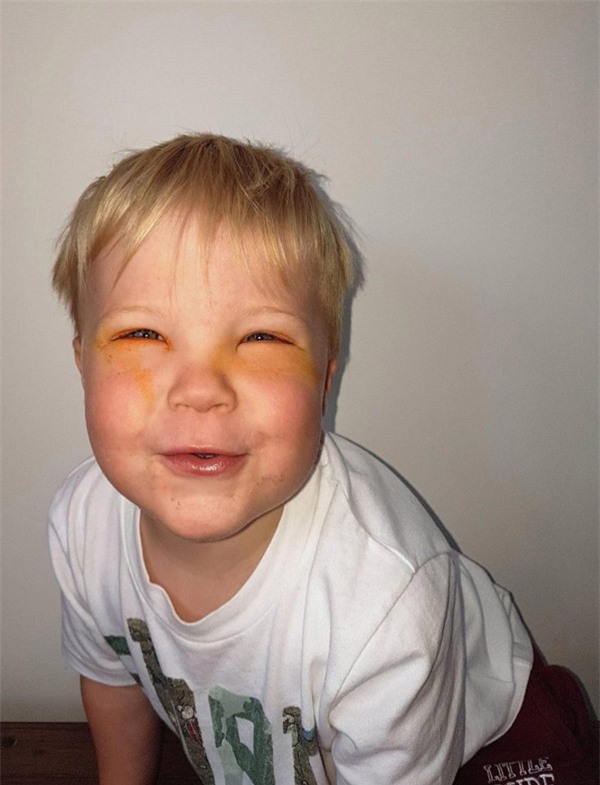 Mẹ vừa nhuộm tóc con trai 2 tuổi bị mù mắt tạm thời sau 20 phút ôm mẹ ngủ   Tin tức Online