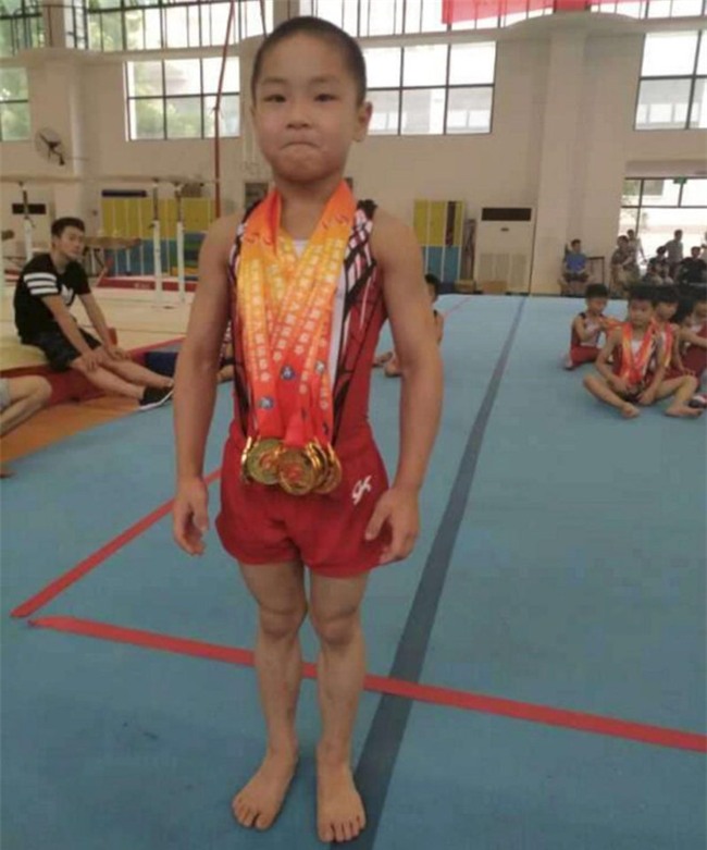 Cau be 7 tuoi gay bat ngo khi so huu co bung 8 mui hinh anh 1