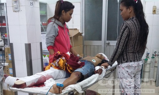 Một thanh niên bị chém nhiều nhát gần đứt lìa chân - Ảnh 1.
