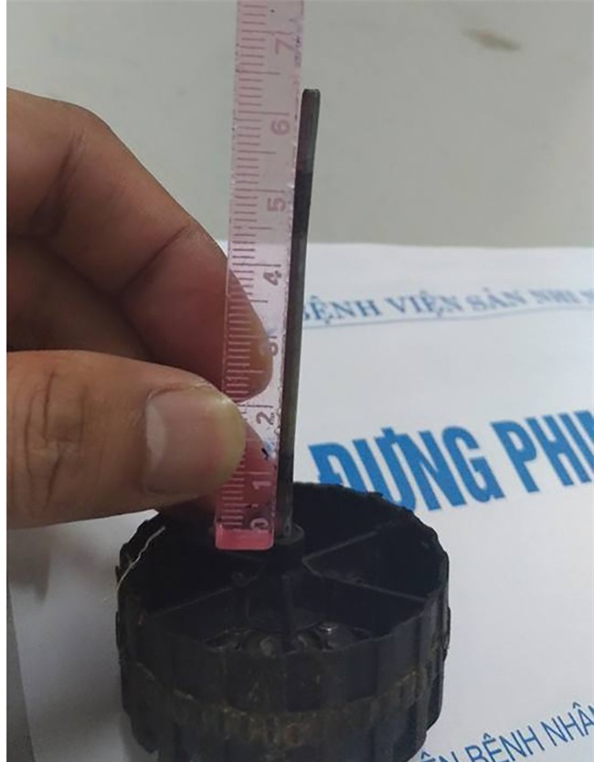 Kinh hãi hình ảnh bánh xe đồ chơi nhọn cắm sâu vào đầu bé gái 11 tháng tuổi - Ảnh 2.