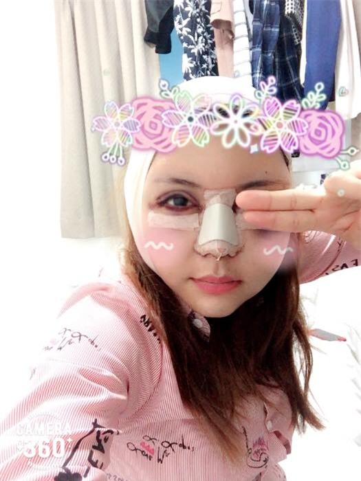 Hậu đập mặt xây lại, học trò Đàm Vĩnh Hưng vui vẻ livestream, lộ gương mặt tụ máu bầm dập - Ảnh 1.