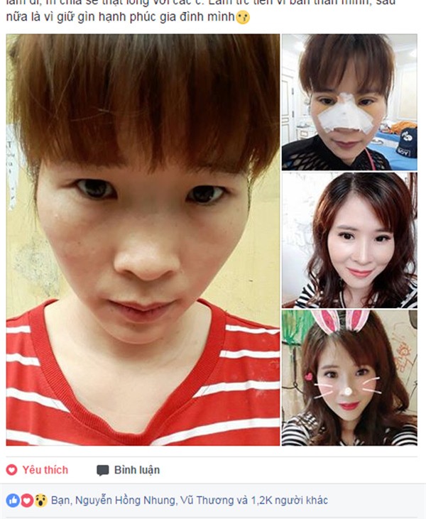 Bà mẹ 3 con quê mùa gây sốt MXH với tâm sự trốn chồng đi thẩm mỹ - Ảnh 2.