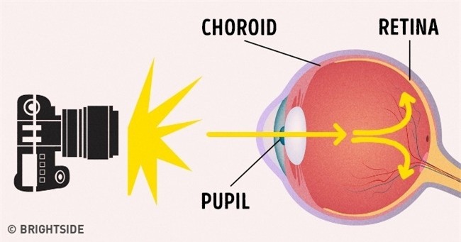 Vì sao đôi lúc chụp ảnh chúng ta bị hiện tượng mắt đỏ? Và đây là cách khắc phục trong 5 giây - Ảnh 2.