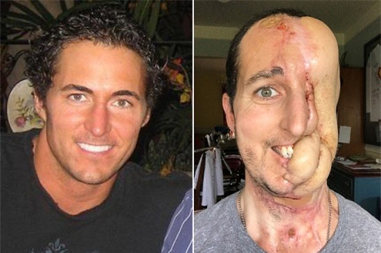 Mất nửa mặt vì ung thư, người đàn ông vẫn quyết tâm truyền cảm hứng về cuộc sống - Ảnh 1.