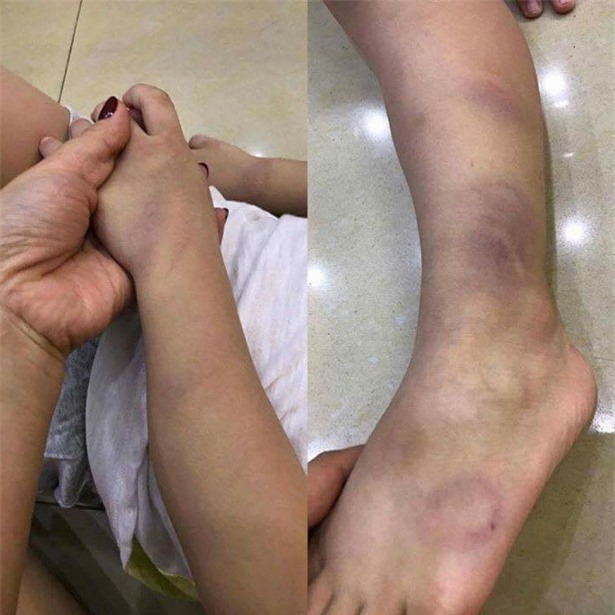 Giao vien Hai Duong danh hoc sinh tim tay bi cho thoi viec hinh anh 1