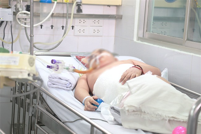 bao dong tre mac viem nao nhat ban tang vot ca nuoc, bac si khuyen cha me can lam ngay dieu nay - 3