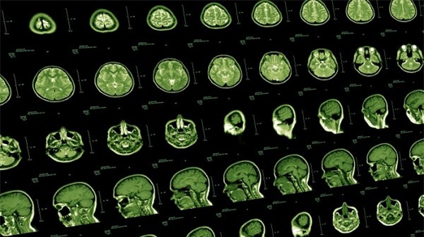 Phát hiện bí mật động trời về những đặc điểm chung của thiên tài - 1