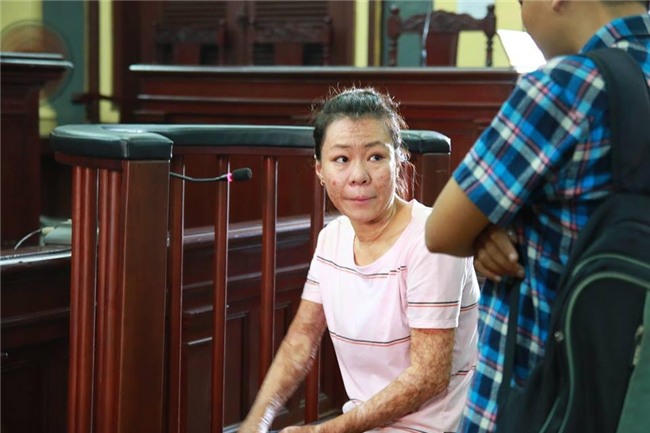 cuồng yêu,axít,người tình,đồng tính