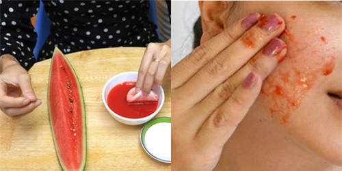 dua-hau-blogtamsuvn3