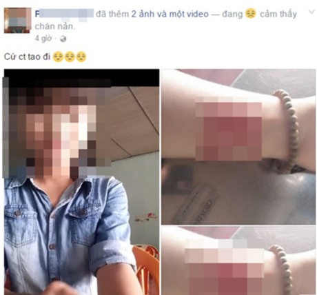 khoc thet vi nhung chieu