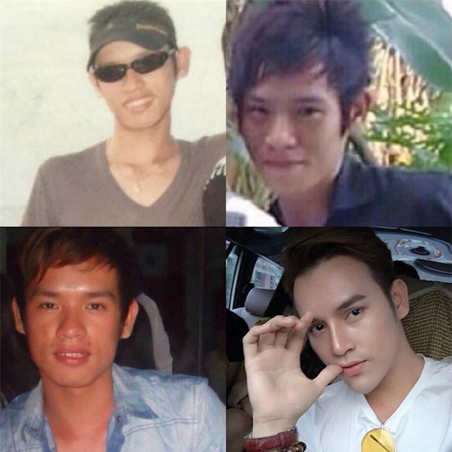 9x chi 200 triệu để phẫu thuật thẩm mỹ, rũ bỏ hình ảnh xấu xí, quê mùa - Ảnh 1.