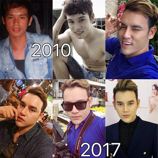 9x chi 200 triệu để phẫu thuật thẩm mỹ, rũ bỏ hình ảnh xấu xí, quê mùa - Ảnh 2.