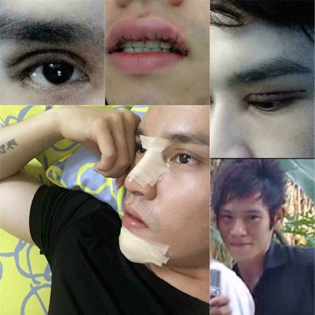 9x chi 200 triệu để phẫu thuật thẩm mỹ, rũ bỏ hình ảnh xấu xí, quê mùa - Ảnh 3.