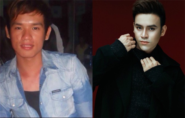 9x chi 200 triệu để phẫu thuật thẩm mỹ, rũ bỏ hình ảnh xấu xí, quê mùa - Ảnh 4.