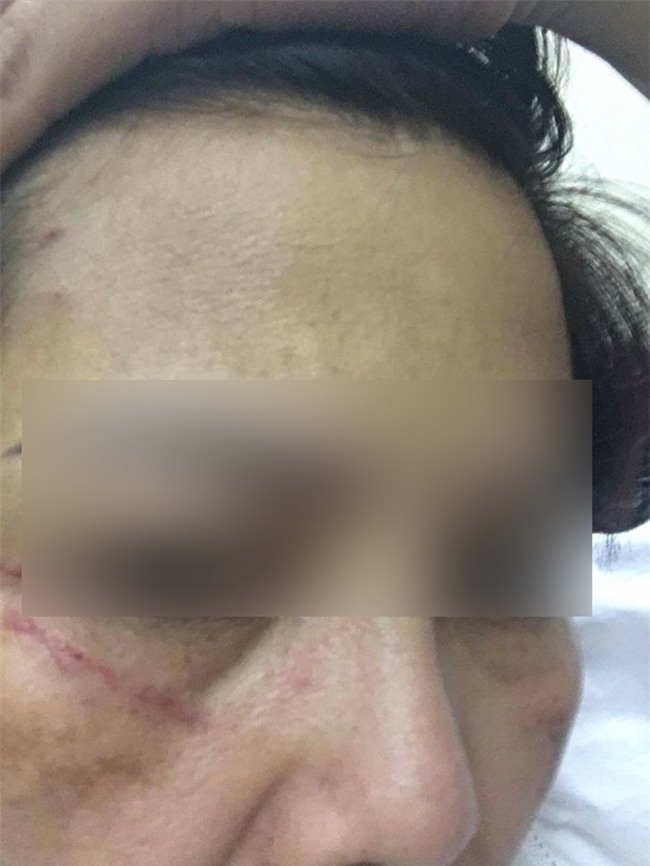 Hà Nội: Hai người phụ nữ đánh nhau ngay tại ngân hàng vì số thứ tự xếp hàng - Ảnh 3.