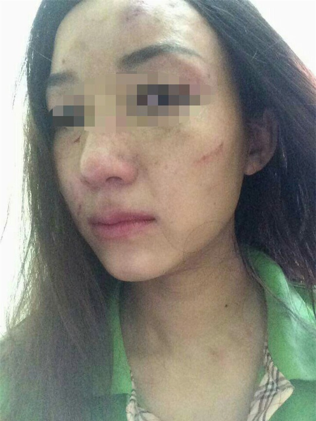 Tố giò me làm bẩn, làm nhái trên facebook, người phụ nữ bị đánh bầm dập - Ảnh 2.