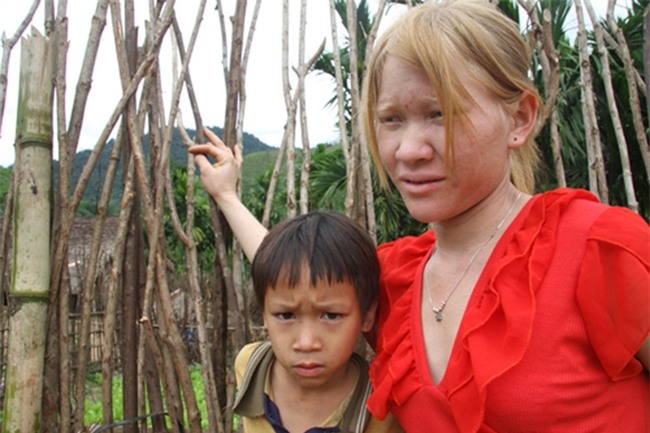 Kỳ lạ chị em người Ca Dong ở Quảng Nam bị xua đuổi, nhà chồng chì chiết vì giống hệt Tây - Ảnh 2.