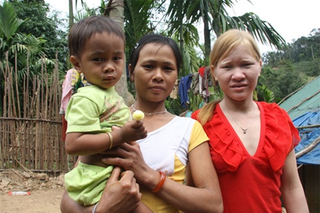 Kỳ lạ chị em người Ca Dong ở Quảng Nam bị xua đuổi, nhà chồng chì chiết vì giống hệt Tây - Ảnh 5.