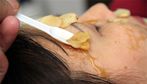 mach ban 3 cach tri  seo, vet tham mun don gian hieu qua hon my pham tien trieu - 4