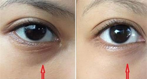 meo-lam-dep-blogtamsuvn