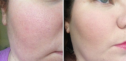 meo-lam-dep-blogtamsuvn7