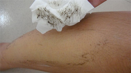 meo-lam-dep-blogtamsuvn1