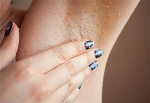 meo-lam-dep-blogtamsuvn5