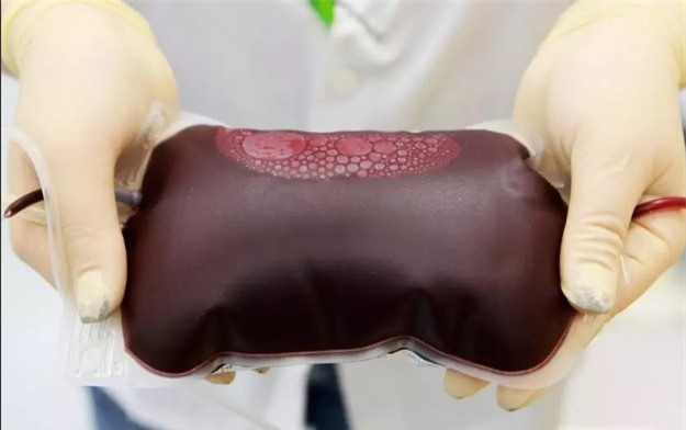 Tai sao AB la nhom mau hiem nhat the gioi? hinh anh 3