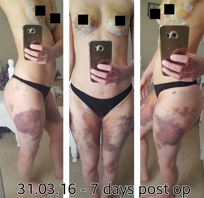 nguoi me khong ngai ngan khoe co the bi tan pha kinh khung trong no luc sinh con - 2