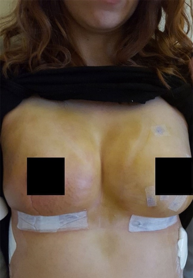 nguoi me khong ngai ngan khoe co the bi tan pha kinh khung trong no luc sinh con - 3