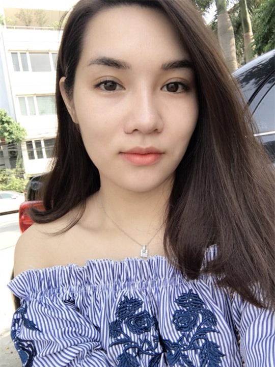 Liều mình làm tận 2 lần, mẹ trẻ tiêm filler mũi sau 2 tuần bóp ra đầy dịch vàng lẫn cả máu - Ảnh 6.