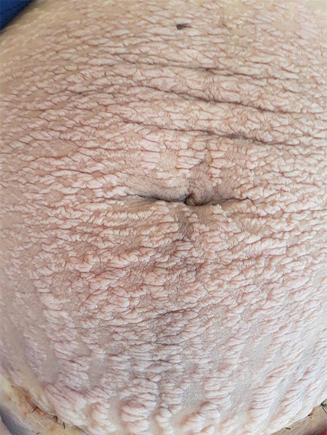 Câu chuyện đằng sau bức ảnh bụng rạn đang khiến cộng đồng mạng dậy sóng - Ảnh 3.