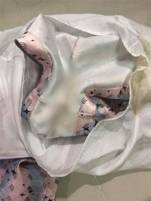 Tưởng đặt được bộ jumpsuit sang xịn về mặc, ai dè nhận được bộ đồ đã cũ lại còn bẩn kinh hoàng - Ảnh 3.