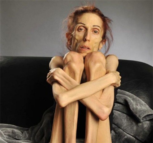 hanh trinh lot xac than ky cua co gai da boc xuong tro thanh thien nga xinh dep - 1